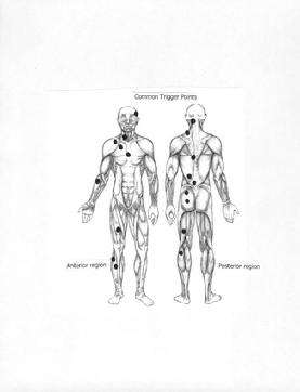 Neuromuscular Trigger Points